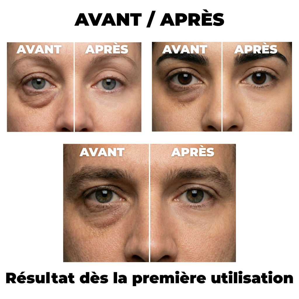 Dr. Melaxin - Eyephalt Correcteur Anti-Cernes