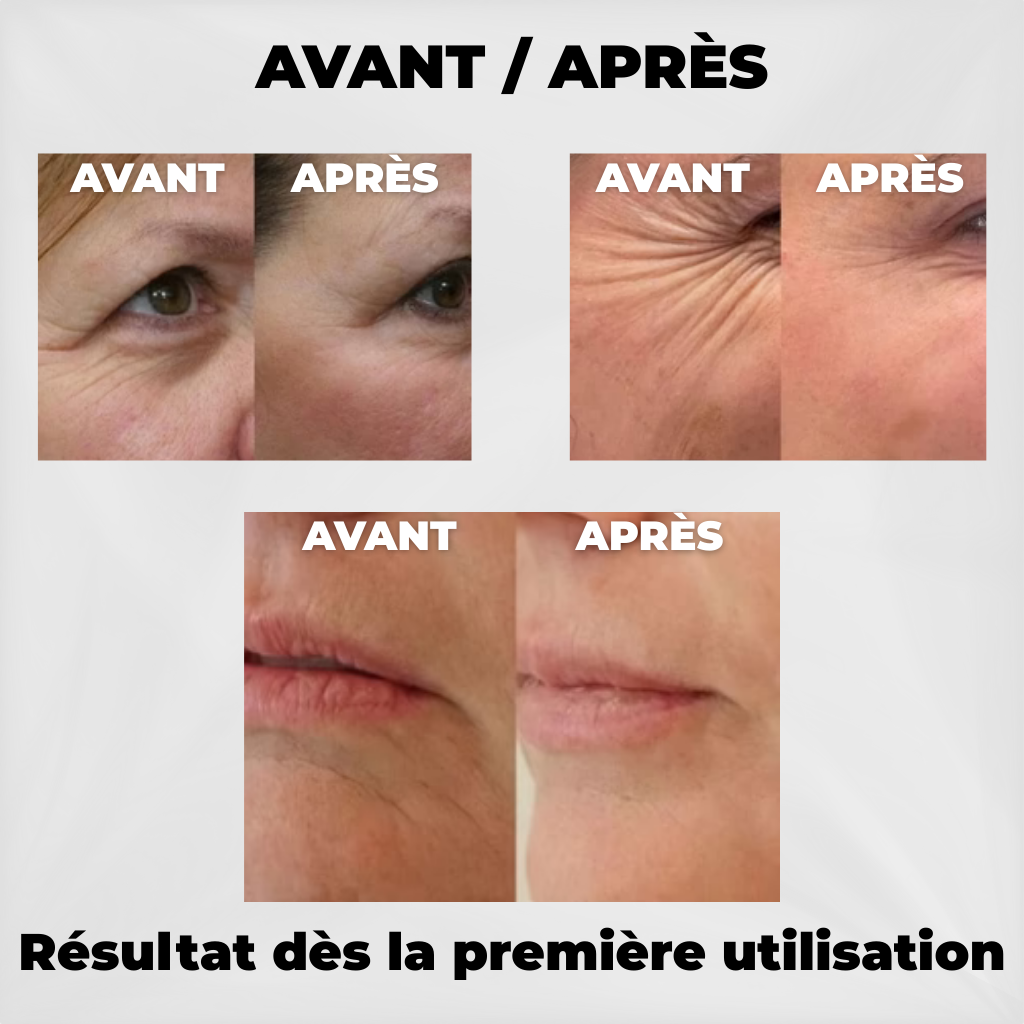 Dr. Melaxin - Stick Baume Liftant